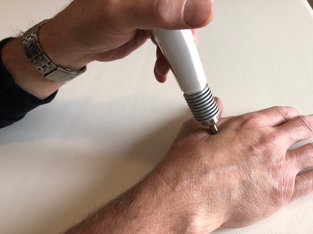 Laser Acupuncture Ottawa