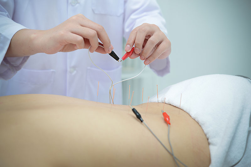 Électroacupuncture Ottawa