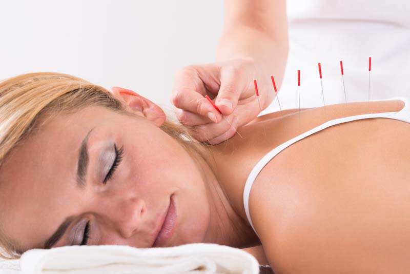 Acupuncture Gatineau